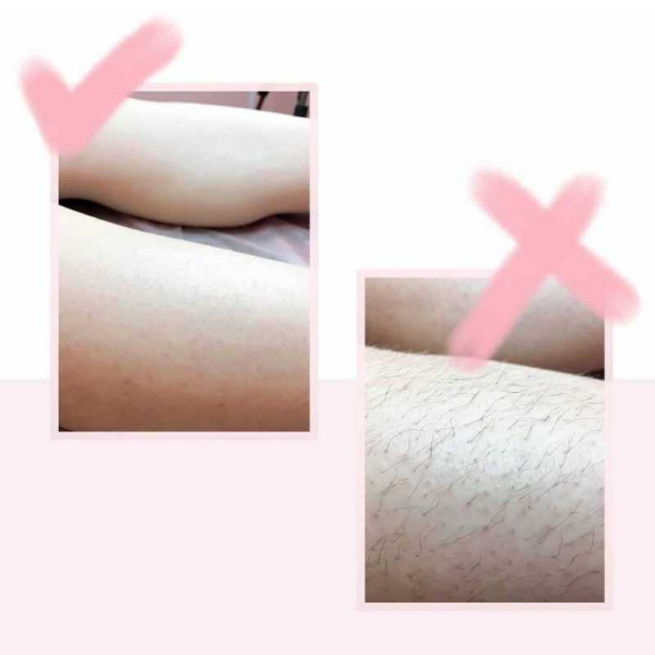 Как сделать шугаринг дома пошагово (+фото)